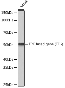 TRK fused gene (TFG) Rabbit mAb