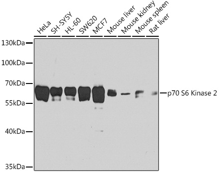 p70 S6 Kinase 2 Rabbit pAb