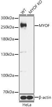 [KO Validated] MYOF Rabbit polyclonal antibody