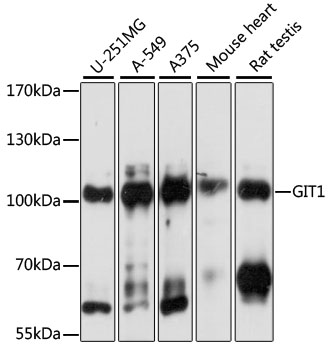 [KO Validated] GIT1 Rabbit polyclonal antibody