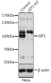 [KO Validated] GIT1 Rabbit polyclonal antibody