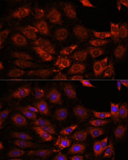 [KO Validated] GIT1 Rabbit polyclonal antibody