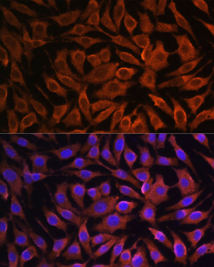 [KO Validated] GIT1 Rabbit polyclonal antibody