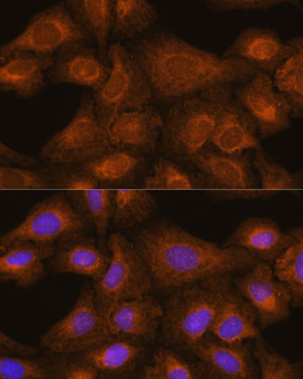 [KO Validated] GIT1 Rabbit polyclonal antibody
