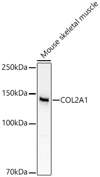 COL2A1 Rabbit polyclonal antibody