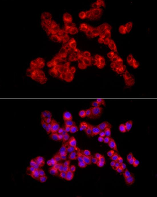 COL2A1 Rabbit polyclonal antibody