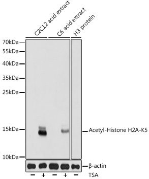 ABclonal:Western blot - Acetyl-Histone H2A-K5 Rabbit pAb (A15620)}