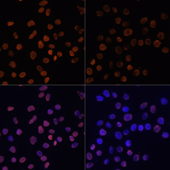ABclonal:Immunofluorescence - Acetyl-Histone H2A-K5 Rabbit pAb (A15620)}