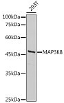 Western blot - MAP3K8 Rabbit pAb (A15623)