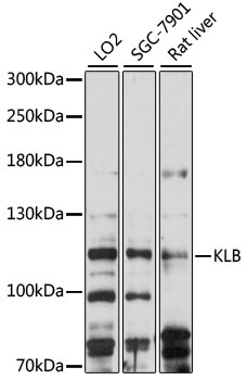 KLB antibody