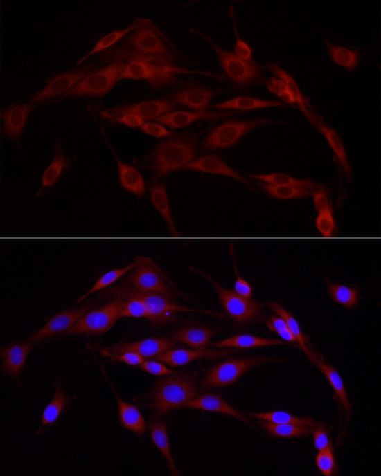 Calnexin Rabbit polyclonal antibody