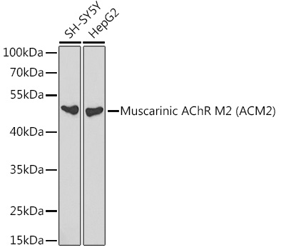 Muscarinic AChR M2 (ACM2) Rabbit pAb