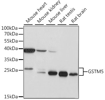 GSTM5 antibody