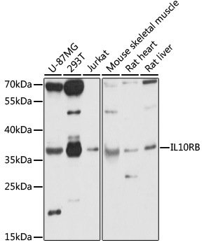 IL10RB Rabbit polyclonal antibody