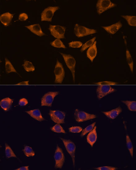 IL10RB Rabbit polyclonal antibody
