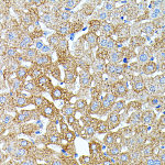 Western blot - Haptoglobin (HP) Rabbit pAb (A1571)