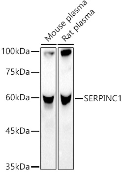 SERPINC1 Rabbit pAb