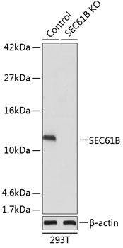 [KO Validated] SEC61B Rabbit polyclonal antibody