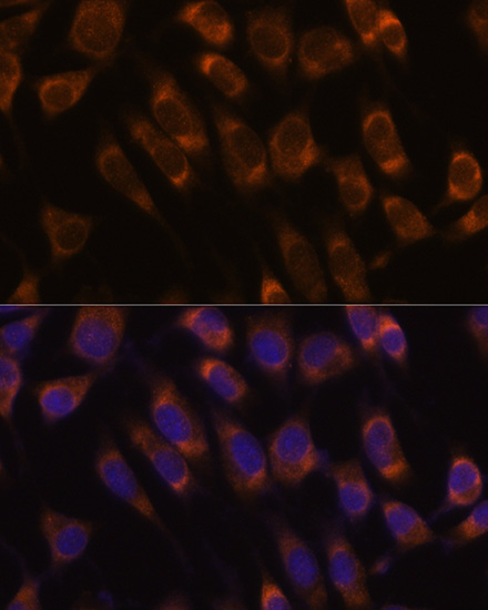 [KO Validated] SEC61B Rabbit polyclonal antibody
