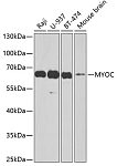 Western blot - MYOC Rabbit pAb (A1589)