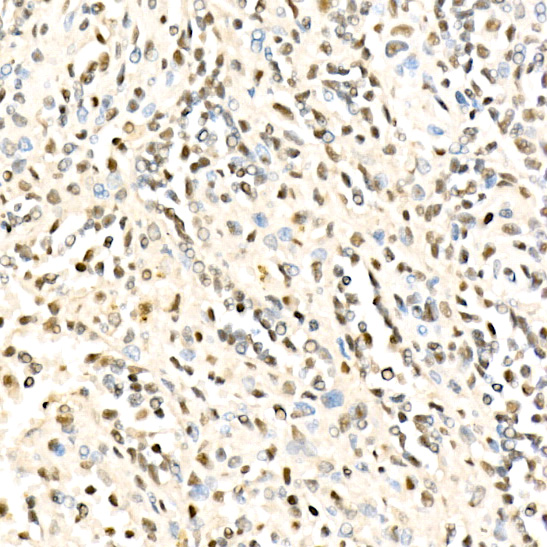 METTL16 Rabbit polyclonal antibody
