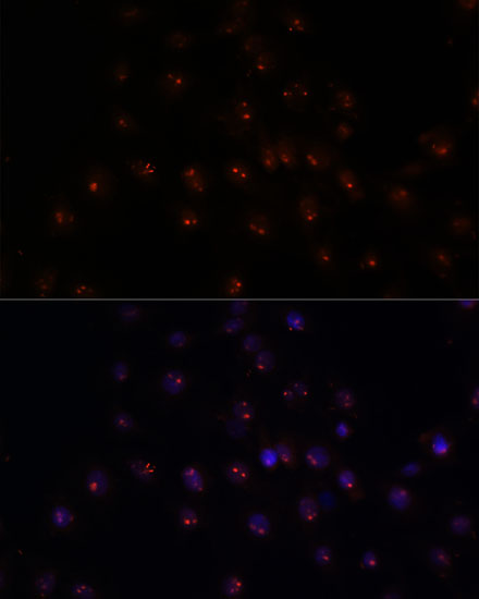 METTL16 Rabbit polyclonal antibody
