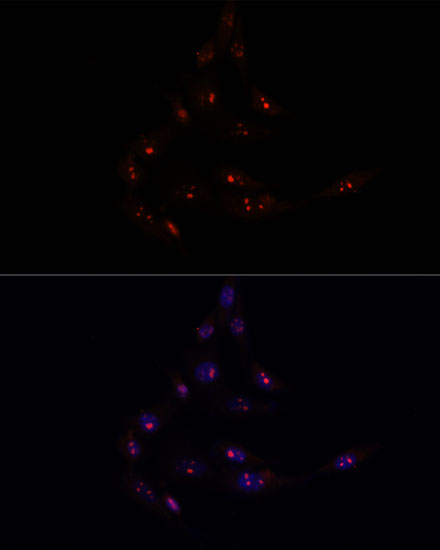 METTL16 Rabbit polyclonal antibody