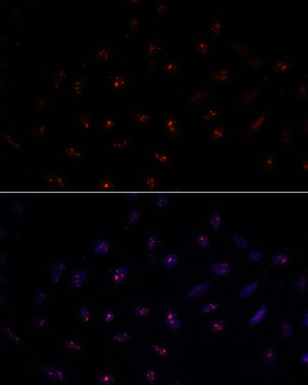 METTL16 Rabbit polyclonal antibody