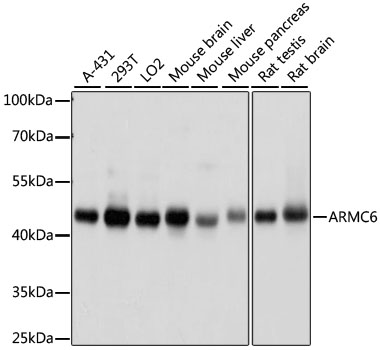 ARMC6 Rabbit polyclonal antibody