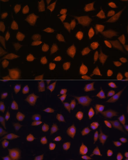 ARMC6 Rabbit polyclonal antibody