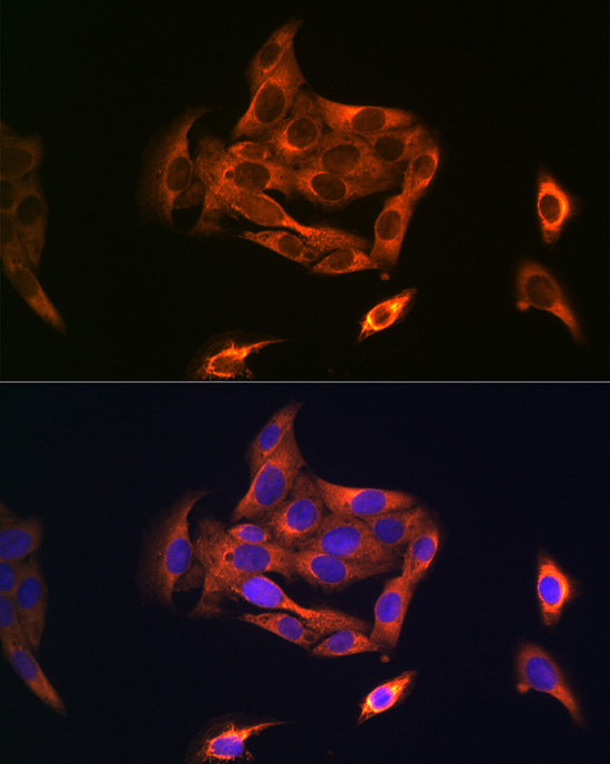 NOSTRIN Rabbit polyclonal antibody