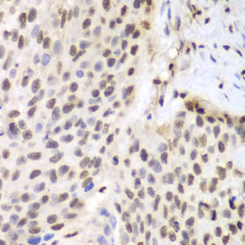 ETS1 Rabbit polyclonal antibody