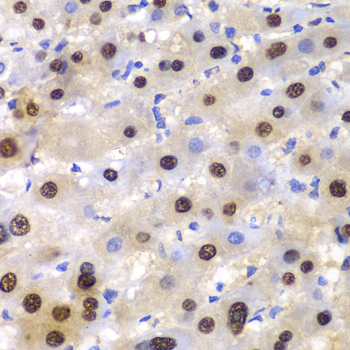 ETS1 Rabbit polyclonal antibody