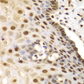 ETS1 Rabbit polyclonal antibody