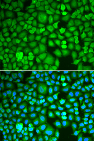 ETS1 Rabbit polyclonal antibody