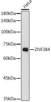 ZNF384 Rabbit polyclonal antibody