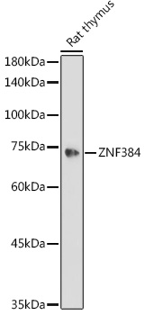 ZNF384 Rabbit polyclonal antibody