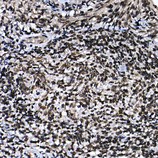 ZNF384 Rabbit polyclonal antibody