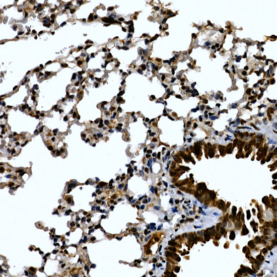 ZNF384 Rabbit polyclonal antibody