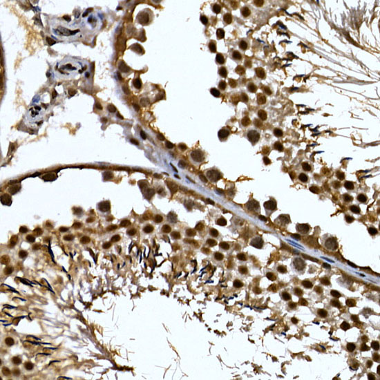 ZNF384 Rabbit polyclonal antibody