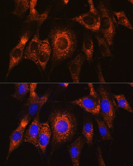 UBAC2 Rabbit polyclonal antibody