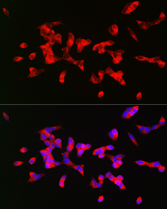 CHRM1 Rabbit polyclonal antibody