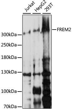FREM2 Rabbit polyclonal antibody
