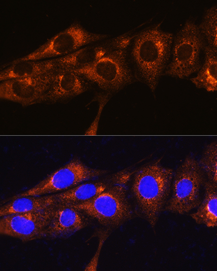 FREM2 Rabbit polyclonal antibody