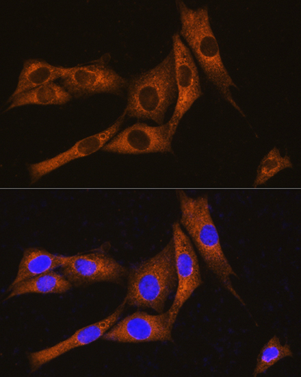 GNAT3 Rabbit polyclonal antibody
