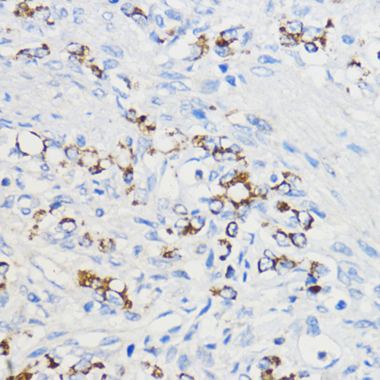 BOLA3 Rabbit polyclonal antibody