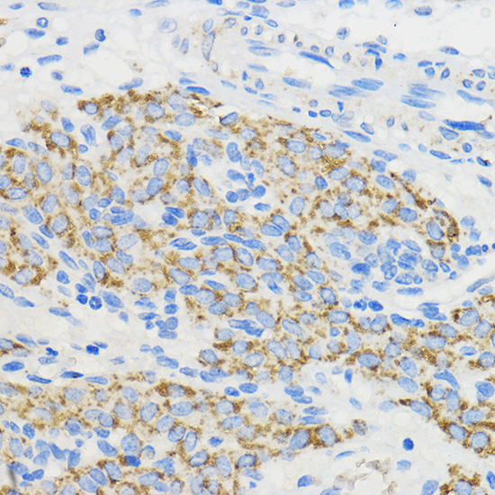BOLA3 Rabbit polyclonal antibody