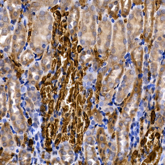 SLC14A1 Rabbit polyclonal antibody