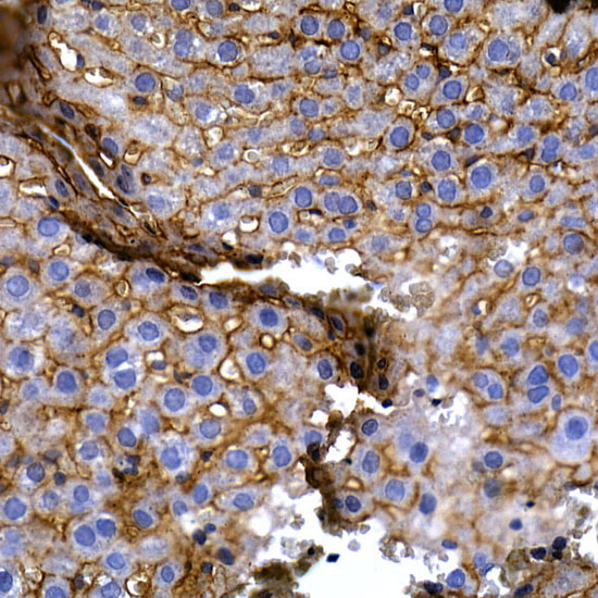 SLC14A1 Rabbit polyclonal antibody