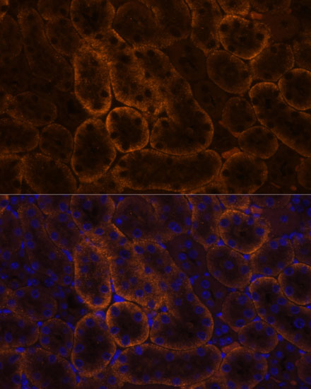 SLC14A1 Rabbit polyclonal antibody
